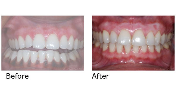  Appealing Lips - Improving