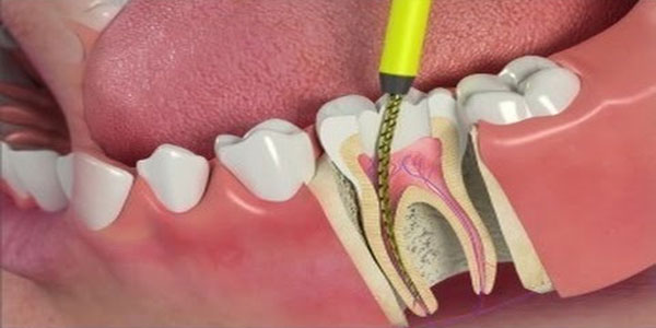  Smile Design 